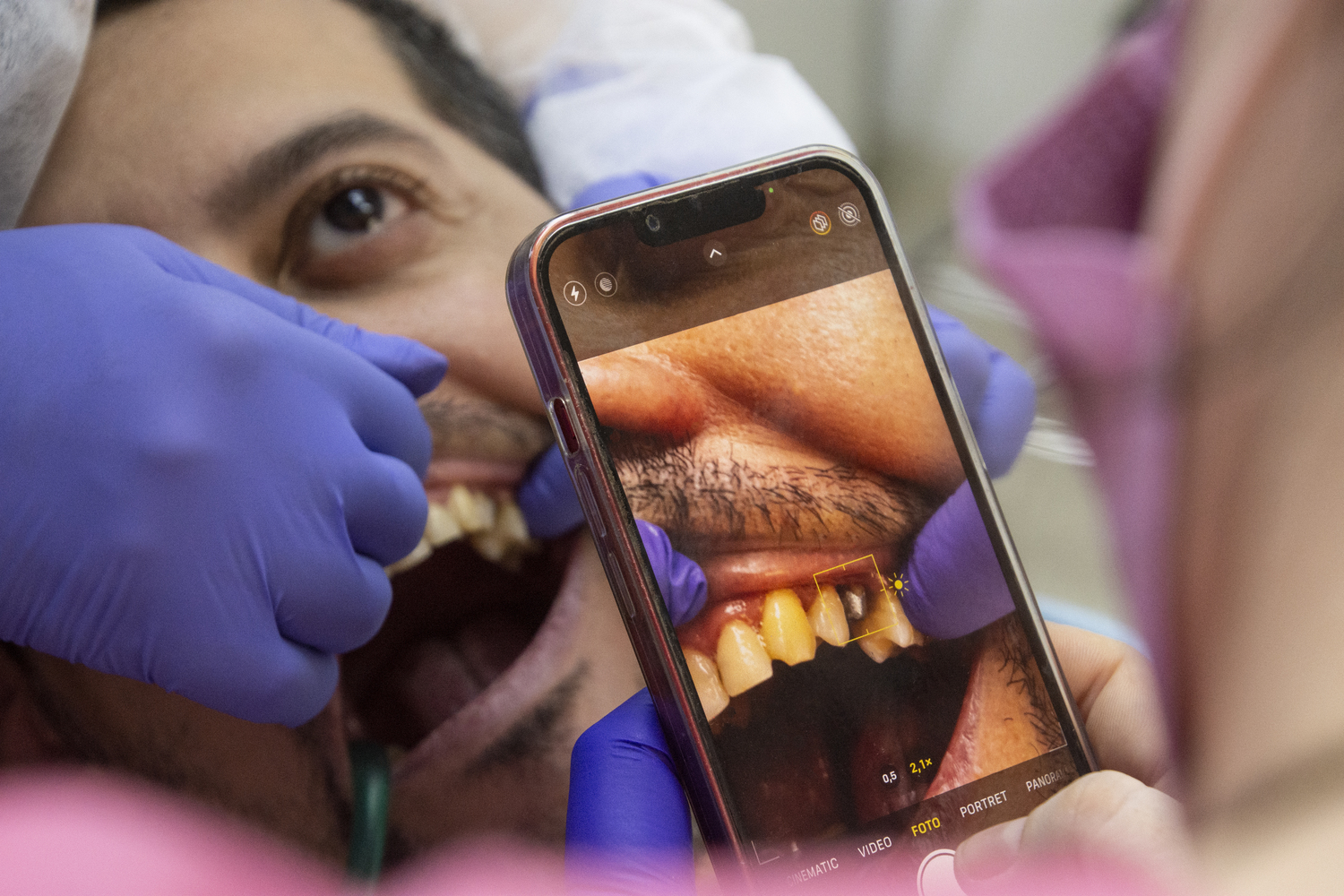 Ce trebuie să știi înainte de un implant dentar în România